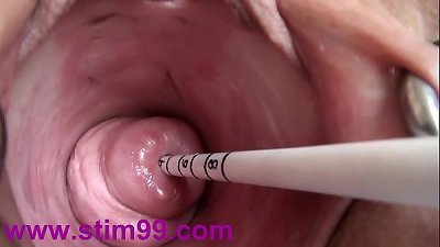 extraordinary Real Cervix plowing insertion chinese Sounds and Objects in Uterus